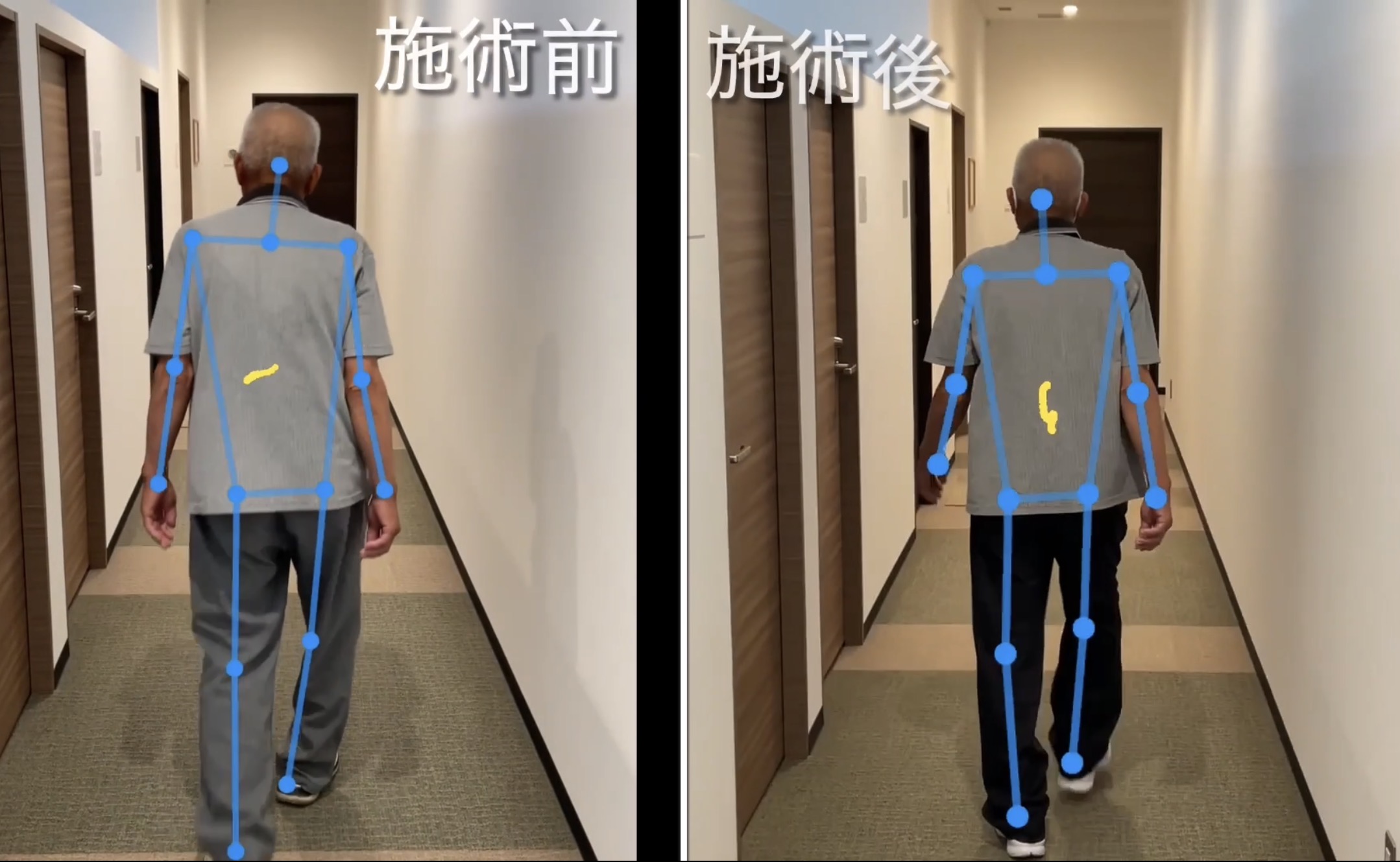【春日市】膝の痛み　整体